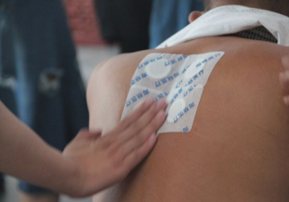 醫院拿回來的三伏天怎么保存 三伏貼中間少貼一次有影響嗎