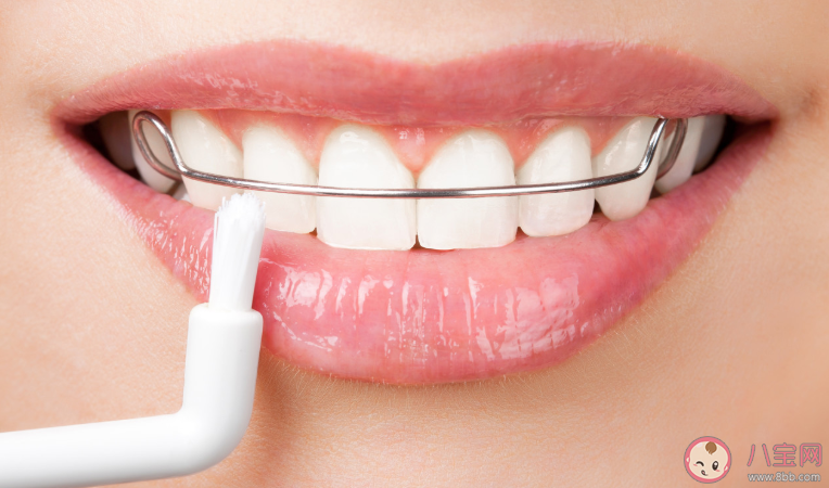 牙齒矯正會有后遺癥嗎 牙齒不及時矯正會有什么后果