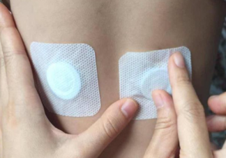 三伏貼可以提高免疫力嗎 三伏貼真的有用嗎