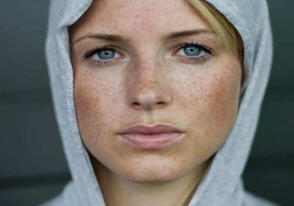 臉上長(zhǎng)斑怎么淡斑 淡斑需要注意什么