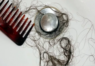 年輕男生掉頭發(fā)是什么原因引起的 掉頭發(fā)吃什么食物能恢復(fù)