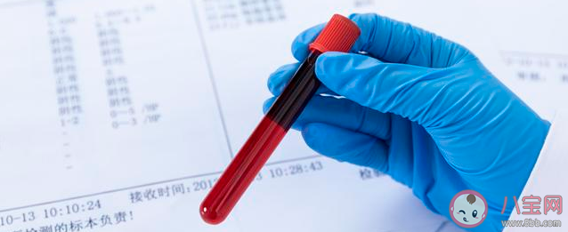 血脂升高是肉吃太多了嗎 高血脂患者應(yīng)該怎么吃