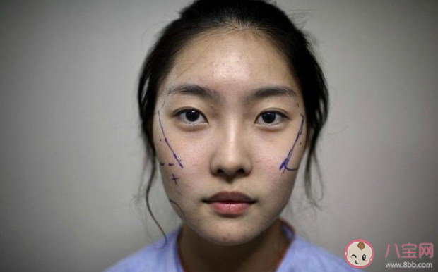 為什么整容低齡化趨勢明顯 年齡多少歲以下不建議整容 為什么整容低齡化趨勢明顯 年齡多少歲以下不建議整容