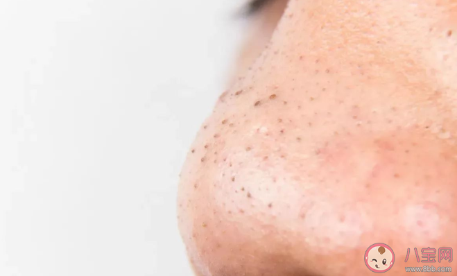 十滴水去黑頭是真的嗎 十滴水去黑頭有用嗎