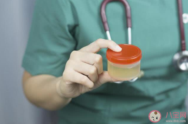 尿可以被稀釋成水嗎 尿液形成過(guò)程是怎樣的 尿可以被稀釋成水嗎 尿液形成過(guò)程是怎樣的