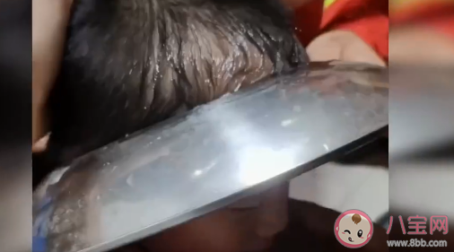 男孩腦袋卡進鍋蓋取不下來具體是怎么回事 孩子要遠離哪些廚房用具 男孩腦袋卡進鍋蓋取不下來具體是怎么回事 孩子要遠離哪些廚房用具