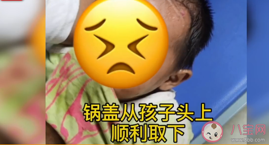 男孩腦袋卡進鍋蓋取不下來具體是怎么回事 孩子要遠離哪些廚房用具 男孩腦袋卡進鍋蓋取不下來具體是怎么回事 孩子要遠離哪些廚房用具