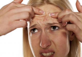 戒糖真的對抑制痘痘有效嗎 如何正確抗糖化