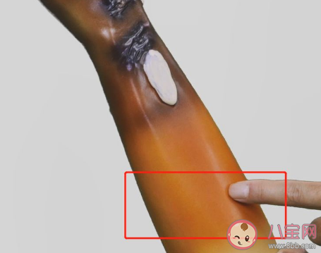 被燙傷后起了水泡最好如何處理 支付寶螞蟻莊園10月11日問題最新答案