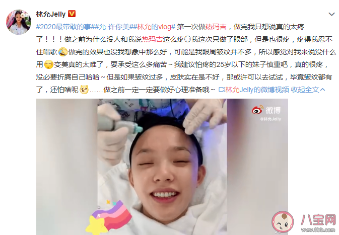 做熱瑪吉到底有多疼 熱瑪吉治療變美效果怎么樣