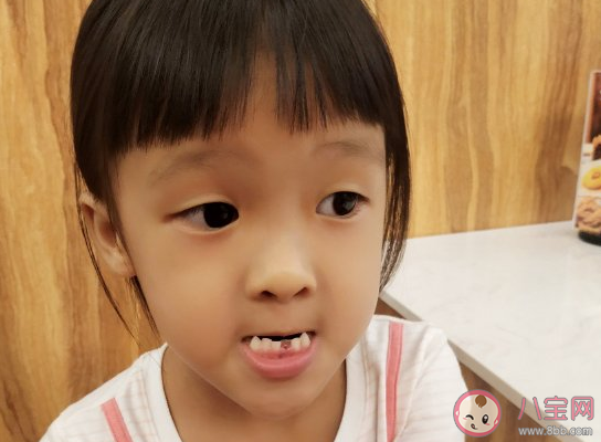 女兒第一次換牙的發朋友圈說說 女兒第一次換牙心情句子