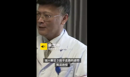 2歲男童近視兩千多度怎么回事 馬凡綜合征是什么