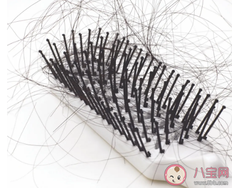 植發群體中90后過半是真的嗎 年輕人脫發怎么調理 植發群體中90后過半是真的嗎 年輕人脫發怎么調理