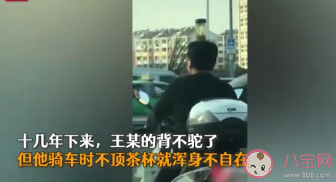 男子頭頂茶杯騎車糾正駝背是怎么回事 駝背要如何矯正