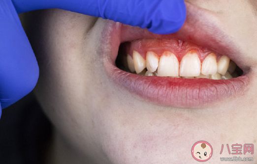 我國超一半人感染幽門螺桿菌怎么回事 感染幽門螺桿菌要怎么治療 我國超一半人感染幽門螺桿菌怎么回事 感染幽門螺桿菌要怎么治療