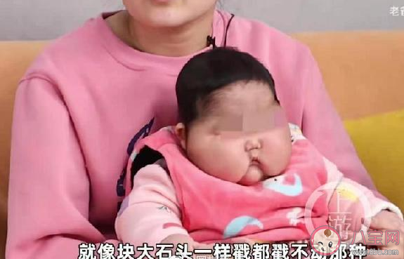 嬰兒用抑菌霜后成大頭娃娃是哪個牌子的 寶寶抑菌霜有什么作用