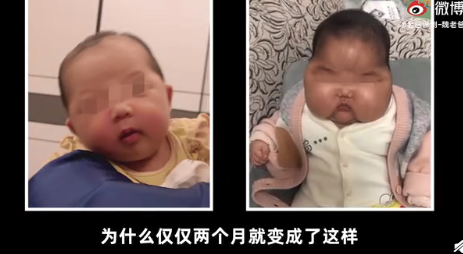 5月大寶寶用嬰兒霜變大頭娃娃是真的嗎 是抑菌霜引起的嗎