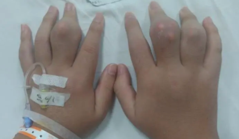 長(zhǎng)期喝奶茶有什么危害案例 長(zhǎng)期喝奶茶對(duì)身體的影響