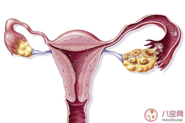 熬夜玩游戲會終身不孕嗎 長期熬夜會卵巢早衰嗎