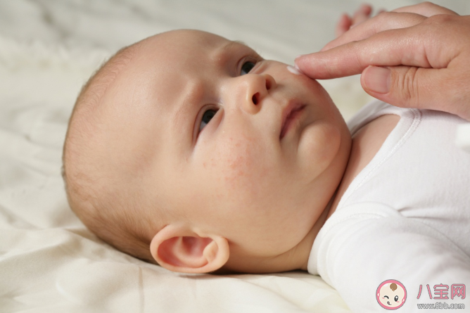 兒童可以使用激素藥膏嗎 正確認識激素的副作用 兒童可以使用激素藥膏嗎 正確認識激素的副作用