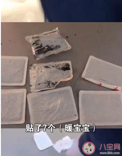 廣州小伙貼7個暖寶寶后背冒煙是怎么引起的 暖寶寶會引起皮膚燙傷嗎 廣州小伙貼7個暖寶寶后背冒煙是怎么引起的 暖寶寶會引起皮膚燙傷嗎