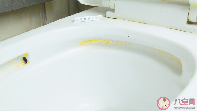 馬桶發黃洗不掉怎么辦 馬桶發黃有異味是什么原因