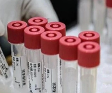 湖北核酸費用降價到多少錢 回湖北需要核酸檢測證明嗎 湖北核酸費用降價到多少錢 回湖北需要核酸檢測證明嗎