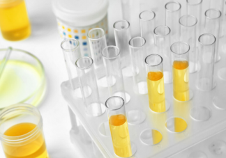 尿毒癥出現(xiàn)年輕化的原因是什么 尿毒癥最多能活幾年