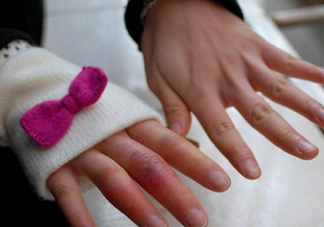 用醋能不能治療凍瘡 臉部?jī)霪徥窃趺椿厥?><p><strong>用醋能不能治療凍瘡 臉部?jī)霪徥窃趺椿厥?/strong></p></a></li>           <li><a href=