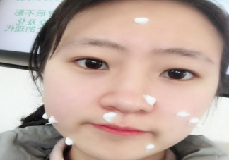 點痣后還能不能敷面膜 點痣了多久能擦護膚品