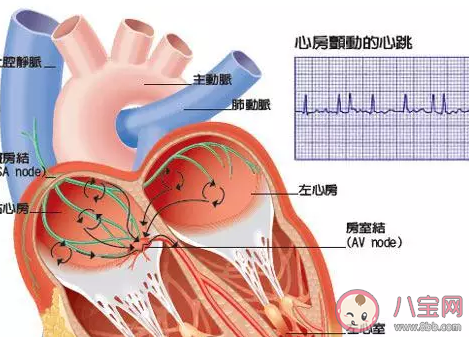蘋果警告iPhone12別靠近心臟起搏器是怎么回事 使用心臟起搏器注意事項 蘋果警告iPhone12別靠近心臟起搏器是怎么回事 使用心臟起搏器注意事項