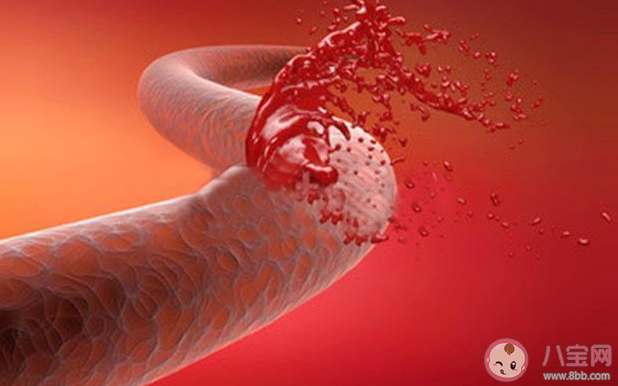 孩子大便帶血會(huì)有哪些病 寶寶便血怎么辦