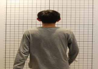 脊柱彎曲納入全國學生常見病監測 怎么及早發現孩子脊柱側彎