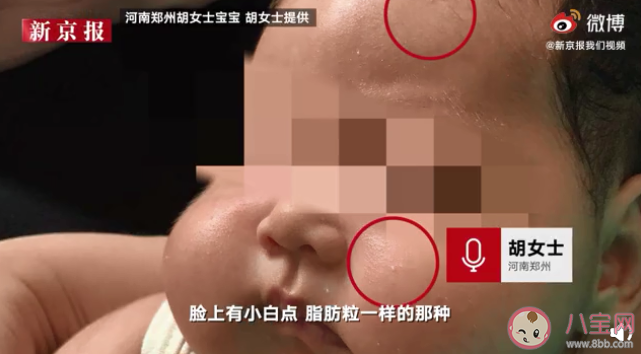 江西哪款嬰兒抑菌霜被曝激素嚴重超標 怎么避免買到偽劣兒童面霜