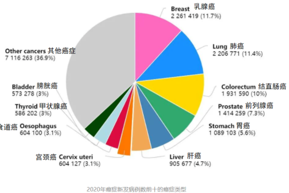 乳腺癌已成全球最常見癌癥 什么人最容易得乳腺癌