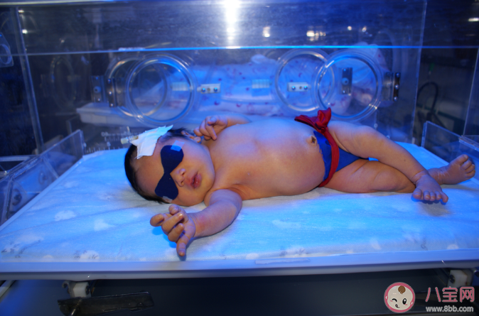新生兒黃疸藍(lán)光要照幾天 新生兒黃疸買個(gè)藍(lán)光燈在家照可以嗎