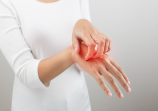 過敏性皮炎用什么藥好 過敏性皮炎患者如何做好生活管理