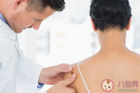 點完痣后當天可以敷面膜嗎 點痣后什么時候可以擦護膚品