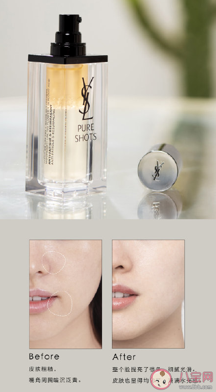 YSL夜皇后精華適合油痘肌嗎 YSL夜皇后精華好用嗎