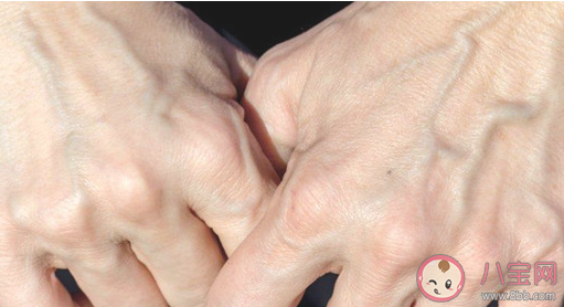 為什么透過皮膚看靜脈血管是藍色 螞蟻莊園3月3日答案