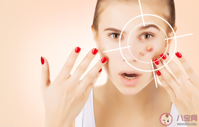 長痘的人最該戒掉哪些食物 痘痘肌膚應該吃哪些食物