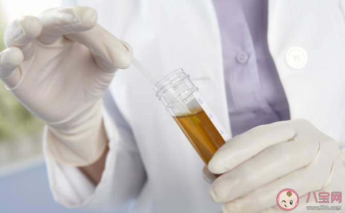 哪些情況要警惕腎臟有問題 慢性腎臟病的常見原因有哪些 哪些情況要警惕腎臟有問題 慢性腎臟病的常見原因有哪些