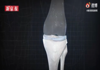 年輕人成半月板損傷主要人群是怎么回事 如何保護(hù)半月板避免受傷