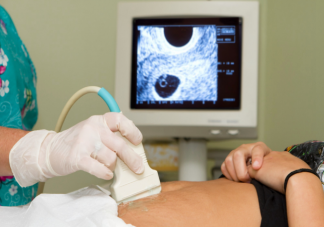 b超懷孕天數(shù)可以精確到天嗎 孕期B超檢查時(shí)間表