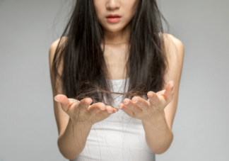 關于脫發的10條真相科普 當代年輕人為什么嚴重脫發