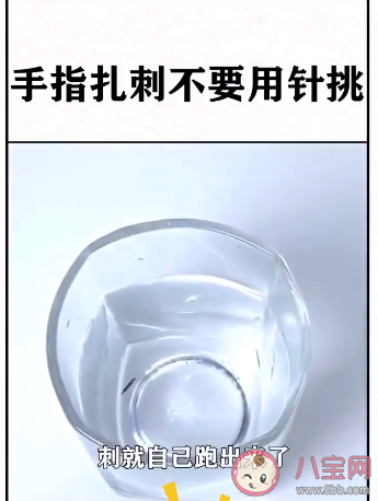 手指扎刺針挑不出來怎么辦 輕松取出手指扎刺的方法有哪些