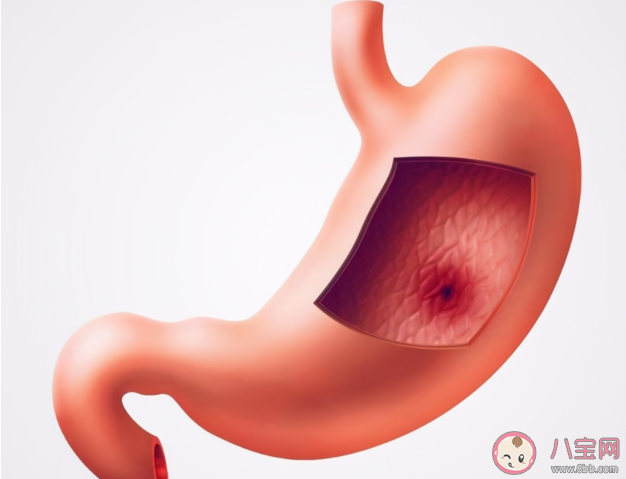 保胃的8個關鍵時間 應杜絕的八條傷胃習慣