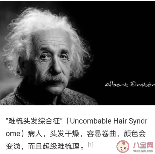 頭發亂是一種病嗎 頭發打結梳不開怎么辦