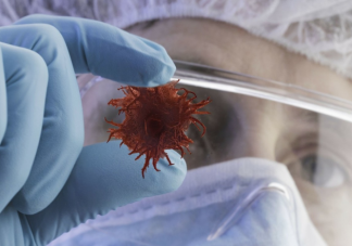 腫瘤早期五大報(bào)警信號(hào)有哪些 患上腫瘤應(yīng)該怎么辦