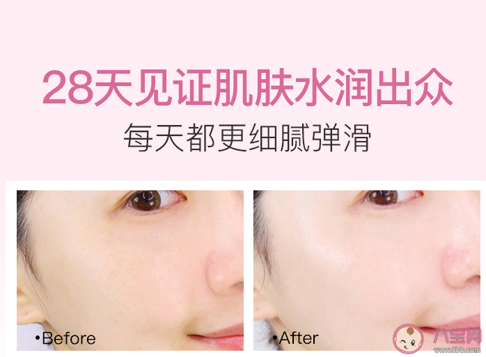 貝德美舒潤保濕乳好不好用 貝德美舒潤保濕乳適合什么膚質(zhì)